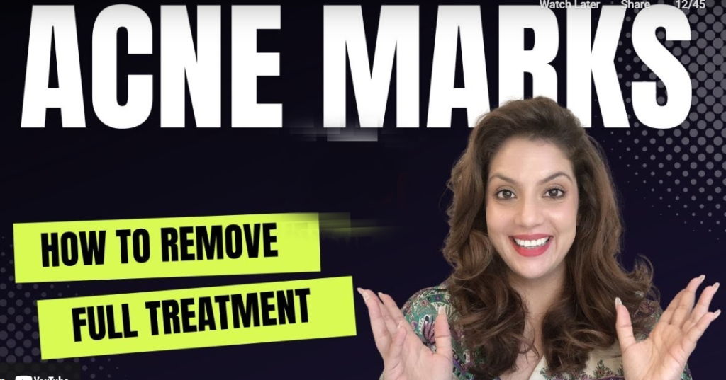 Skin break out marks evacuation at domestic