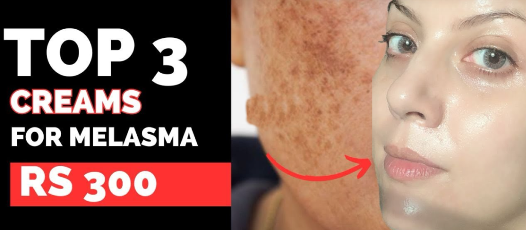 Treat Melasma
